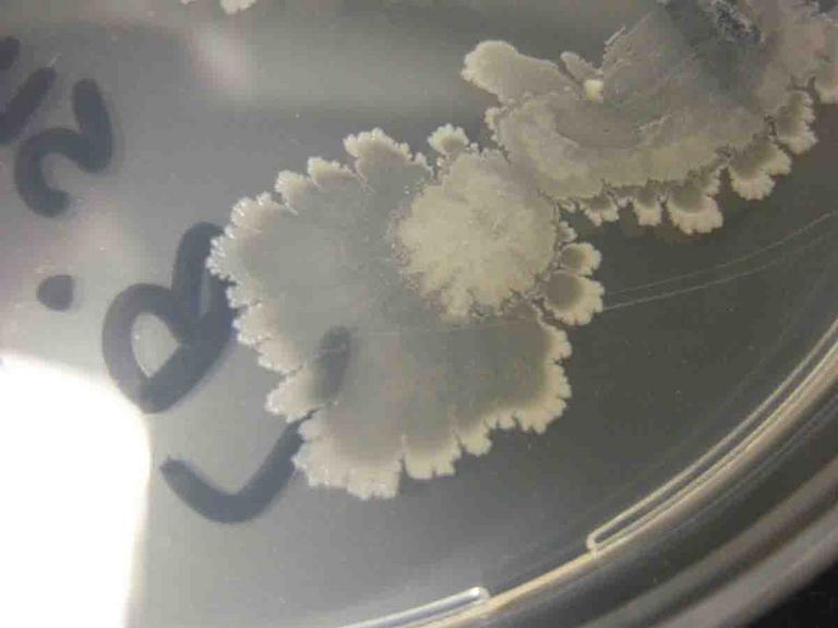 Bacterial Colonies & Streak Plate: Free Images & Photographs from