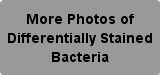 More Photos of Differentially Stained Bacteria Button