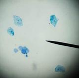Human Cheek Epithilial Cells Stained With Methylene Blue 400xTM