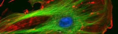Fluoresced Eukaryotic Cell, NIH
