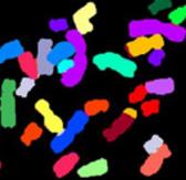Color-coded Chromosomes, Institut of Human Genetics