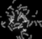 Metaphase chromosomes from a female human lymphocyte, stained with Chromomycin A3