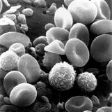 Blood cells: RBCs, Platelets & Leukocytes