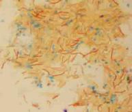Endospore stained Bacillus subtilis @ 1000xTM