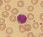 Lymphocyte White Blood Cell and Erythrocyte Red Blood Cell
