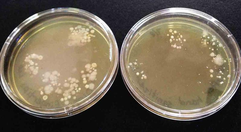 Touch plates of bacteria on fingertips: Left plate dirty hands, right plate after alcohol-based hand sanitizer.