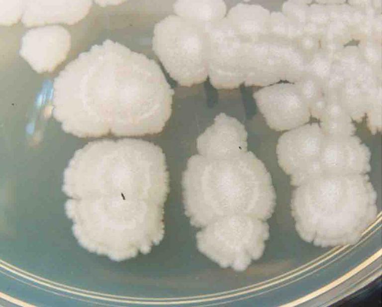 Bacillus subtilis Colonies Growing on TSY Agar