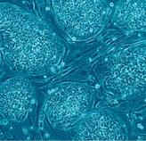 Human Embryonic Stem Cells