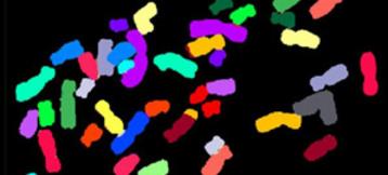 Color Coded Chromosomes Using Fluorescent Dyes