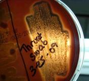 Blood Agar Bacterial Growth Medium Showing Beta Hemolysis