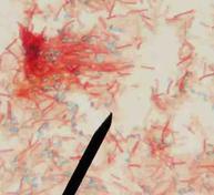 Endospore Staining procedure: Primary stain, malachite green, being applied to slide over a water bath.