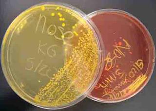 Mannitol Salt Agar grows halophilic (salt-loving) bacteria. Pathogenic Staph is growing on the left (yellow side) and normal flora Staph are growing on the right (pink). ​