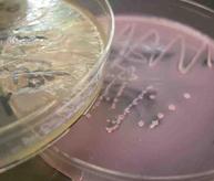 MacConkey's Agar growing Gram-negative bacteria; pink lactose fermenting bacterial colony above colorless non-lactose fermenting bacterial colony.