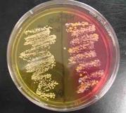 Mannitol Salt Agar with Pathogens 9left) and Normal Flora (right)