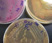 The differential aspect of   is based on  microbial metabolism. MacConkey's Agar Gram-negative bacteria that can ferment the sugar lactose grow in pink colonies.