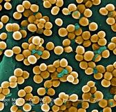 Staphylococcus aureus by Janice Haney Carr